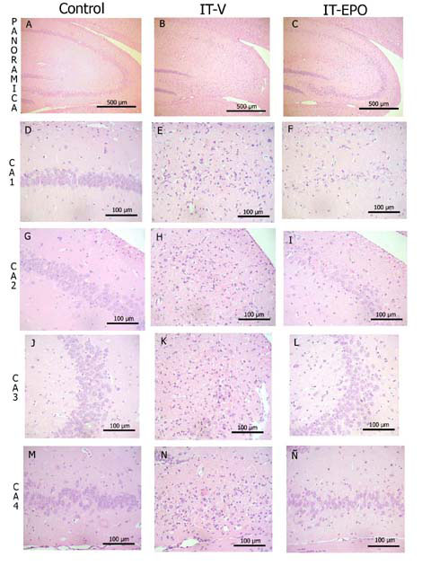 Figura 4. Hipocampo dorsal. La isquemia global por 10 minutos produjo prdida neuronal en todas las regiones del hipocampo (B,E,H,K,N). La EPOhr-bas (C, F, I, L, ) protegi las regiones CA2, CA3 Y CA4 (I, L, ). Hematoxilina - Eosina.
A,B,C: Vista panormica.   D,E,F: Sector CA1 del hipocampo. E,F: Prdida neuronal. E: Reaccin glial.   G,H,I: Sector CA2 del hipocampo. I: cierto grado de conservacin del patrn de organizacin de la capa neuronal.   J,K,L: Sector CA3 del hipocampo. L: aspecto semejante al control.   M,N,: Sector CA4 del hipocampo. : aspecto semejante al control.
